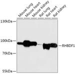 RHBDF1 Antibody in Western Blot (WB)