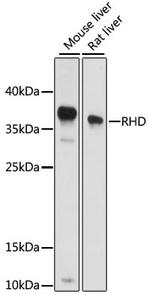 RHD Polyclonal Antibody