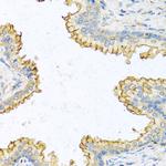 RNASE13 Polyclonal Antibody