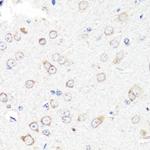 RNF149 Antibody in Immunohistochemistry (Paraffin) (IHC (P))