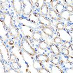 RNF149 Antibody in Immunohistochemistry (Paraffin) (IHC (P))