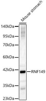 RNF149 Antibody in Western Blot (WB)