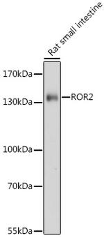 ROR2 Polyclonal Antibody