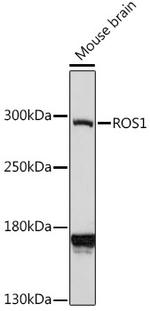 ROS1 Polyclonal Antibody