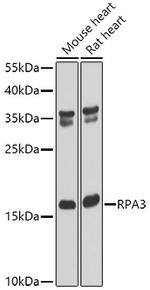 RPA14 Antibody in Western Blot (WB)