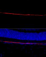 RPE65 Antibody in Immunocytochemistry (ICC/IF)