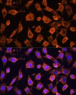RPL11 Polyclonal Antibody