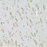 RPL13 Antibody in Immunohistochemistry (Paraffin) (IHC (P))