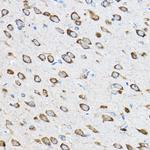 RPL23 Antibody in Immunohistochemistry (Paraffin) (IHC (P))