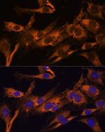 RPL36AL Antibody in Immunocytochemistry (ICC/IF)