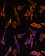 RPL36AL Antibody in Immunocytochemistry (ICC/IF)