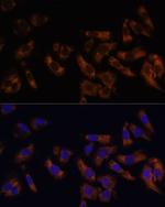 RPL36AL Antibody in Immunocytochemistry (ICC/IF)