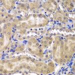 RPL5 Polyclonal Antibody