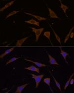 RPL7 Polyclonal Antibody