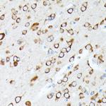 RPL7 Antibody in Immunohistochemistry (Paraffin) (IHC (P))