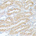 RPL7 Antibody in Immunohistochemistry (Paraffin) (IHC (P))