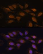 RSK3 Polyclonal Antibody