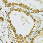 RPS7 Antibody in Immunohistochemistry (Paraffin) (IHC (P))