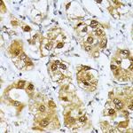 RRAGD Polyclonal Antibody