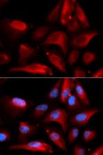 S100A11 Polyclonal Antibody