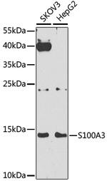 S100A3 Polyclonal Antibody