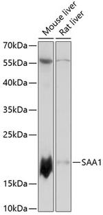 SAA Polyclonal Antibody