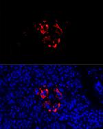 Chromogranin C Polyclonal Antibody