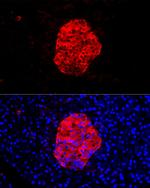 Chromogranin C Antibody in Immunocytochemistry (ICC/IF)
