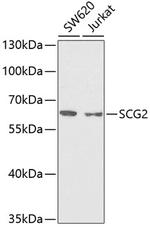 Chromogranin C Antibody in Western Blot (WB)