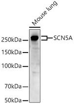SCN5A Polyclonal Antibody