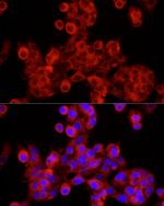 SEC24C Polyclonal Antibody