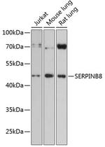 SERPINB8 Polyclonal Antibody
