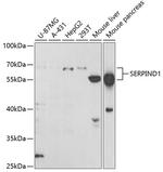 Heparin Cofactor II Polyclonal Antibody