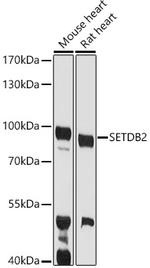 SETDB2 Polyclonal Antibody