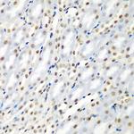 SF3B3 Antibody in Immunohistochemistry (Paraffin) (IHC (P))