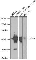 SGCB Polyclonal Antibody