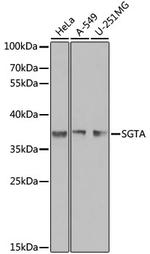 SGTA Antibody in Western Blot (WB)