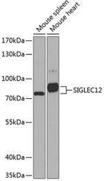 SIGLEC12 Polyclonal Antibody