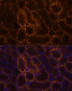 SLC14A1 Antibody in Immunohistochemistry (Paraffin) (IHC (P))