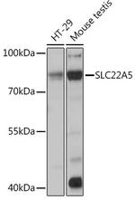 SLC22A5 Antibody in Western Blot (WB)