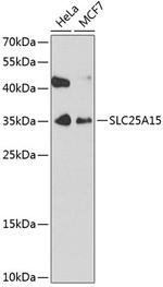 ORNT1 Polyclonal Antibody
