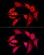 SLC27A1 Polyclonal Antibody