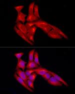 SLC27A1 Antibody in Immunocytochemistry (ICC/IF)