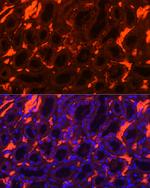 SLC4A1 Antibody in Immunohistochemistry (Paraffin) (IHC (P))