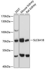 SLC6A18 Antibody in Western Blot (WB)
