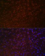 Dopamine Transporter Antibody in Immunohistochemistry (Paraffin) (IHC (P))