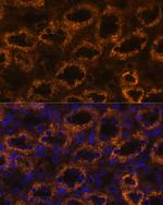 SLC7A9 Antibody in Immunohistochemistry (Paraffin) (IHC (P))