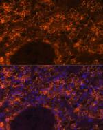SLC7A9 Antibody in Immunohistochemistry (Paraffin) (IHC (P))
