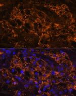 SLC7A9 Antibody in Immunohistochemistry (Paraffin) (IHC (P))