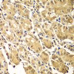 SMAD2/SMAD3 Antibody in Immunohistochemistry (Paraffin) (IHC (P))